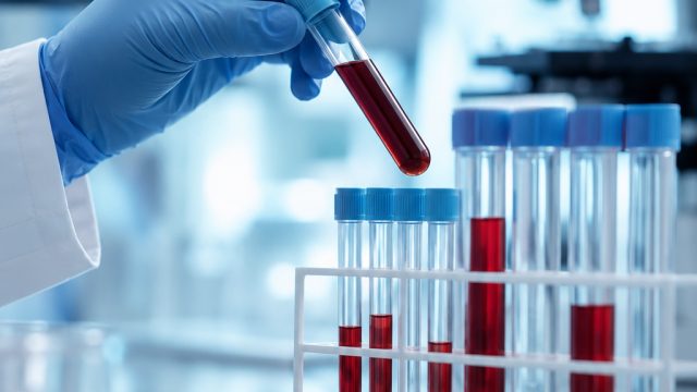 The Liquid Biopsy Market: A Surge Towards $7.05 Billion by 2030
